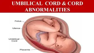 Umbilical Cord & Cord Abnormalities