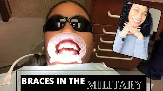Getting Adult Braces In The Military & Tips On Cleaning and Keeping White Teeth | Air Force Edition