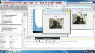 MATLAB CONTRAST ENHANCEMENT TECHNIQUES