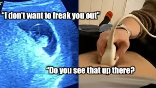 WHAT?!? 8 Weeks Pregnant Ultrasound with baby 4