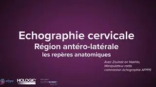 Echographie cervicale : région antéro latérale les différents repères anatomique