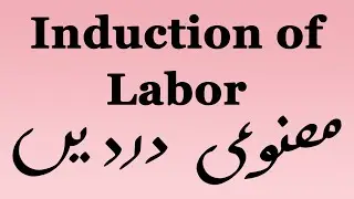 Induction of labor (Urdu/Hindi)