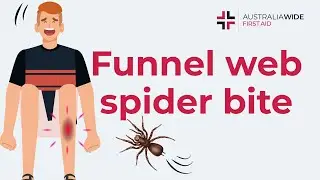 Funnel-Web Spider Bite First Aid: Step-by-Step Instructions