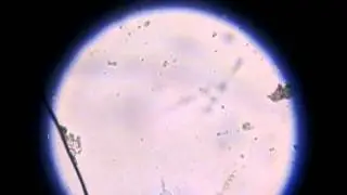 B.coli trophozoite