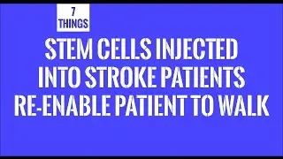 Stem Cells Injected Into Stroke Patients Re-Enable Patient To Walk