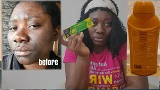 cocobutter  vs lemovate  the most powerful cream for chocolate skin