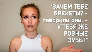 Брекеты. Моя история | Braces. My story