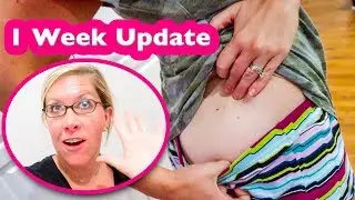 Testosterone Pellet Procedure + 1 Week Update