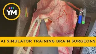 A.I. simulator training brain surgeons | Your Morning