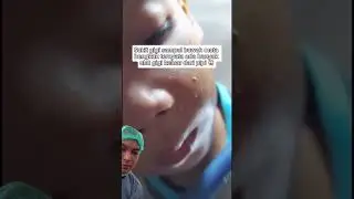 Menurut kalian ulat yang muncul di pipi tersebut benar berasal dari gigi berlubang ? Mitos or Fakta?