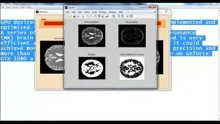 Projects on Matlab for Image Processing | Thesis on Matlab for Image Processing