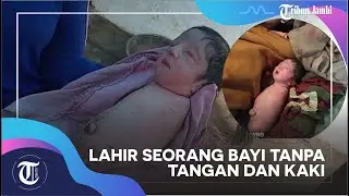 Lahir Seorang Bayi Tanpa Tangan dan Kaki, Diduga Ini Penyebabnya