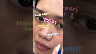 Cara mengatasi pori pori besar 🛒✅