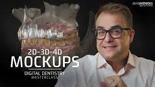 Test a New Smile BEFORE the Dental Treatment