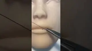 Как ушить рану на губе / How to suture a wound on a lip