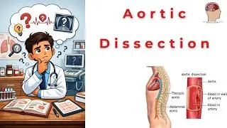 🚨 SUDDEN TEARING CHEST PAIN? It Could Be AORTIC DISSECTION!