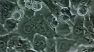 Кремний  ДокФильм СССР. Удивительные свойства и польза для организма.