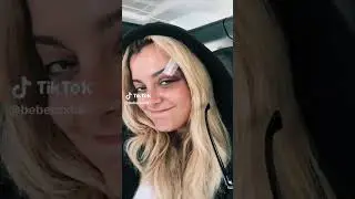 Bebe Rexha Hurt At Concert