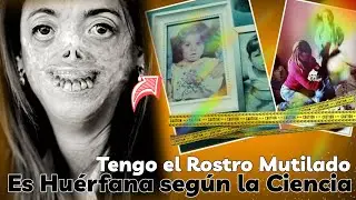 La piel se 