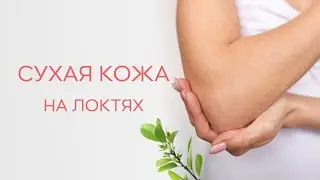 🔔​ С чем может быть связана сухость и потемнение кожи на локтях?