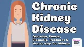 Chronic Kidney Disease - Overview, Causes, Diagnosis, Treatment & How to Help You Kidneys