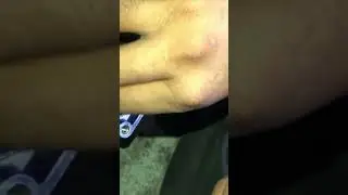Car self starter motor assembling