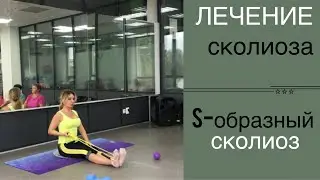 Лечение сколиоза. s-образный сколиоз. Часть 2