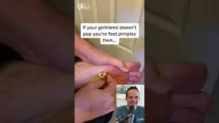DOCTOR REACTS TO POPPING “GARLIC” FOOT PIMPLE! 😱#shorts #reaction