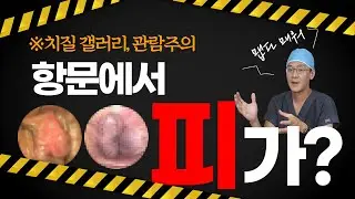 항문출혈! 혈변의 원인은? 사진으로 보는 항문질환, 치질, 치핵
