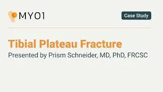 Dr. Prism Schneider discusses a Tibial Plateau Fracture case