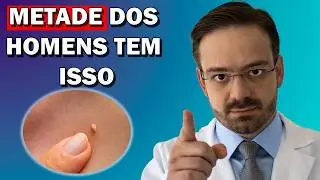 Você Pode Ter HPV e Nem Sabe!