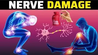 1# Vitamin To Cure NERVE Damage Permanently | Peripheral Neuropathy