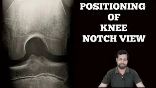 HOW TO DO KNEE NOTCH VIEW X-RAY. (Beclere method intercondylar view).  #xrayclasses #knee #anatomy