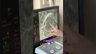Учусь на гинеколога, подпишись❤️