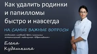 Как удалить родинки и папилломы быстро и навсегда!