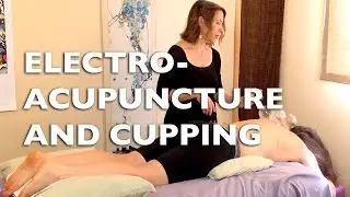 Electro-acupuncture and Cupping