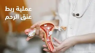 عملية ربط عنق الرحم