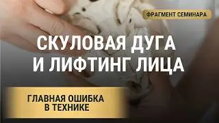 Скуловая дуга Алгоритм Молодости Носогубка