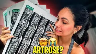 FINALMENTE UM DIAGNÓSTICO DA MINHA LOMBAR! | *to chateada com os comentários!*
