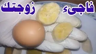 ماذا يحدث للرجل عند تناول الموز قبل مباشرة الزوجة بساعة banana benifits