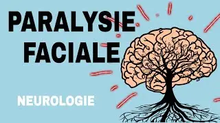 NEUROLOGIE : PARALYSIE FACIALE 🌟
