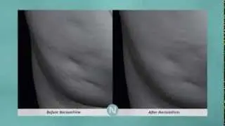 NeriumFirm! Nerium International's Newest Breakthru!