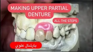 MAKING AN UPPER PARTIAL DENTURE ON METAL FRAMEWORK WITHOUT ARTICULATOR (ALL THE STEPS) IN 4K 