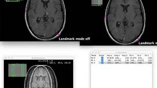 Launching BigWarp from BigDataViewer
