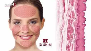 Fotona 4D: 4 Dimensions of Facial Rejuvenation