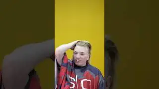 He almost went bald😂