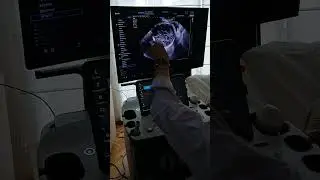 Aquí empleamos el RS85 Prestige de Samsung en una Eco Obstétrica