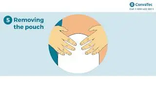 Esteem+ Moldable Pouch Application Instructions.