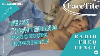 FaceTite: Neck-Tightening Procedure Experience