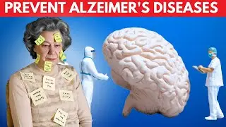 8 Ways to Prevent Alzheimer's Disease